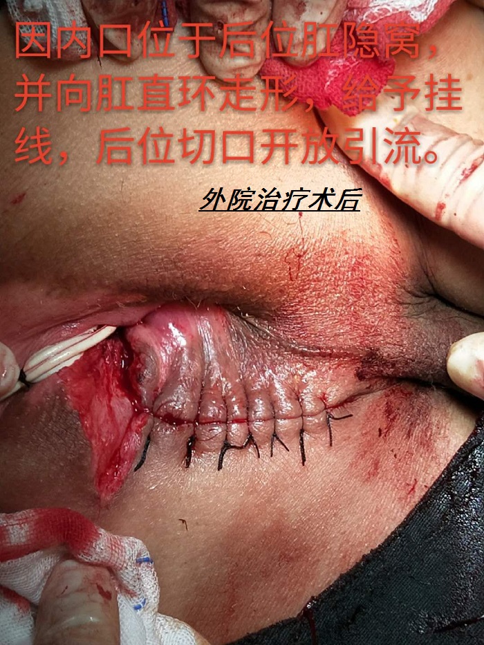 mmexport1538625247470.jpg